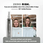 RECOVER HOME - Stain Remover Spray - RECOVER