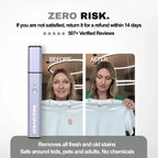 RECOVER ULTRASONIC Pen - RECOVER